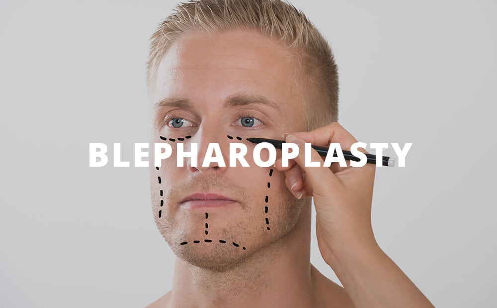 Blepharoplasty in Denver