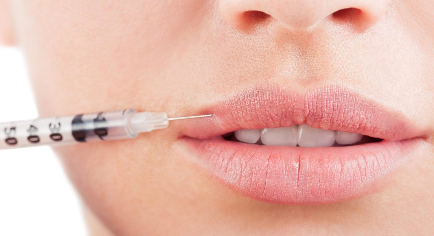 Permanent Lip Augmentation Permanent Lip Augmentation