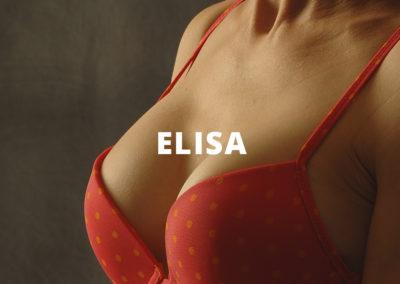 Elisa Breast Augmentation Gallery