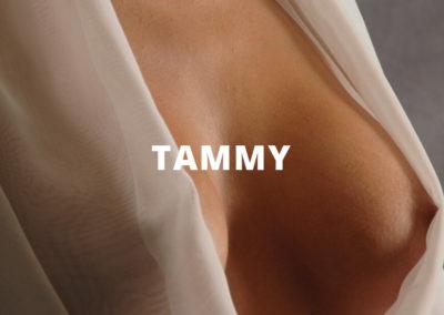 Before & After Breast Augmentation Tammy