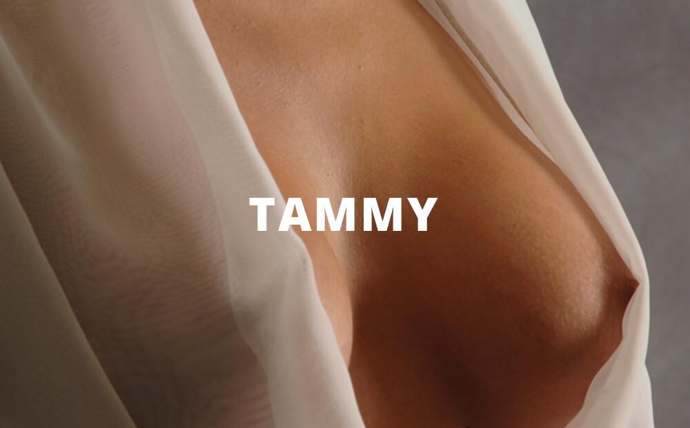 Before & After Breast Augmentation Tammy