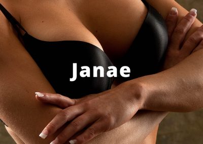 janae Breast Augmentation Pics