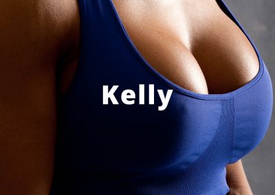 Before & After Breast Augmentation Kelly