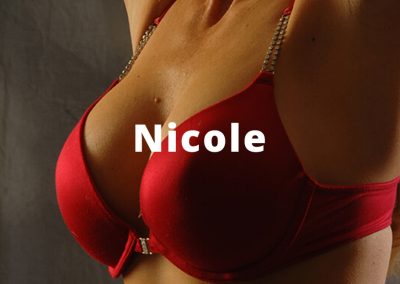 Nicole Breast Augmentation Before and After