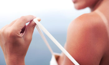 A Quick Guide to Sunburn Severity