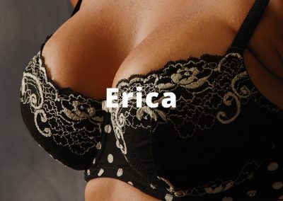 Erica Breast Augmentation Gallery
