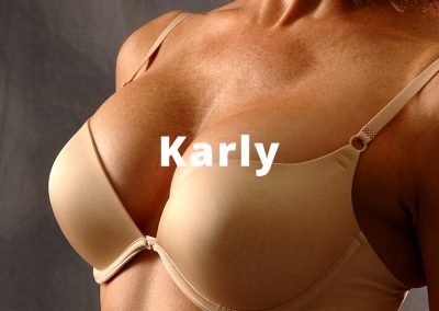 Karly Breast Breast Augmentation