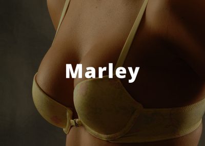 Marley Breast Augmentation Photos