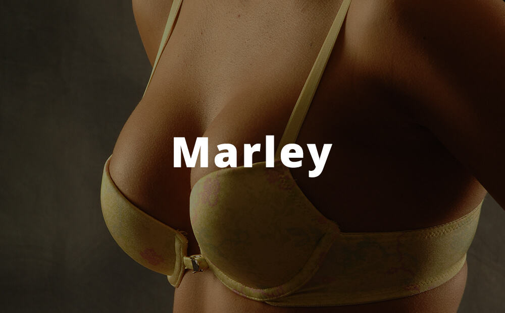 Marley Breast Augmentation Photos