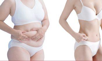 Is Tumescent Liposuction Right For Me?