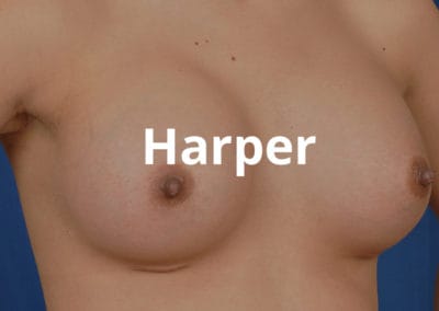 Harper Breast Augmentation Surgery