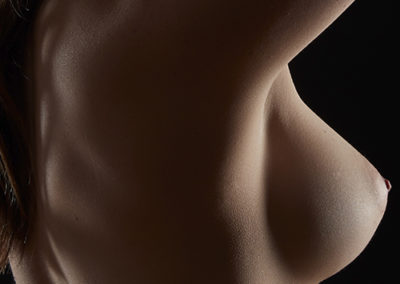 teardrop breast implants results