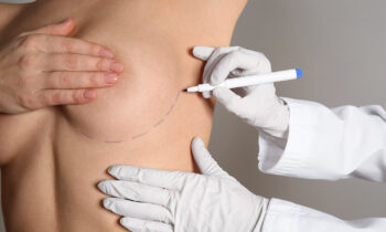 Trends in Breast Augmentation for 2024: A Look at the Latest Trends and Techniques