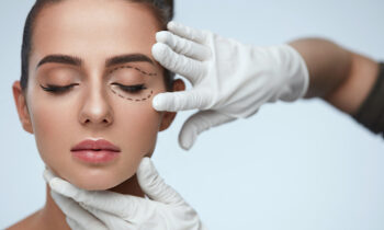 What to Expect from Eyelid Surgery