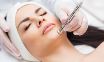 Benefits of Microdermabrasion