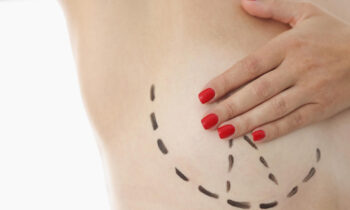 Preparing for Spring with a Breast Lift in Denver