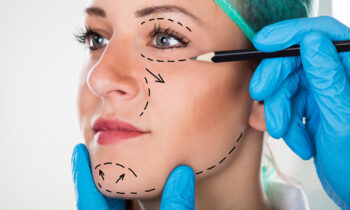 The Benefits of a Deep Plane Facelift: A Younger Look That Lasts
