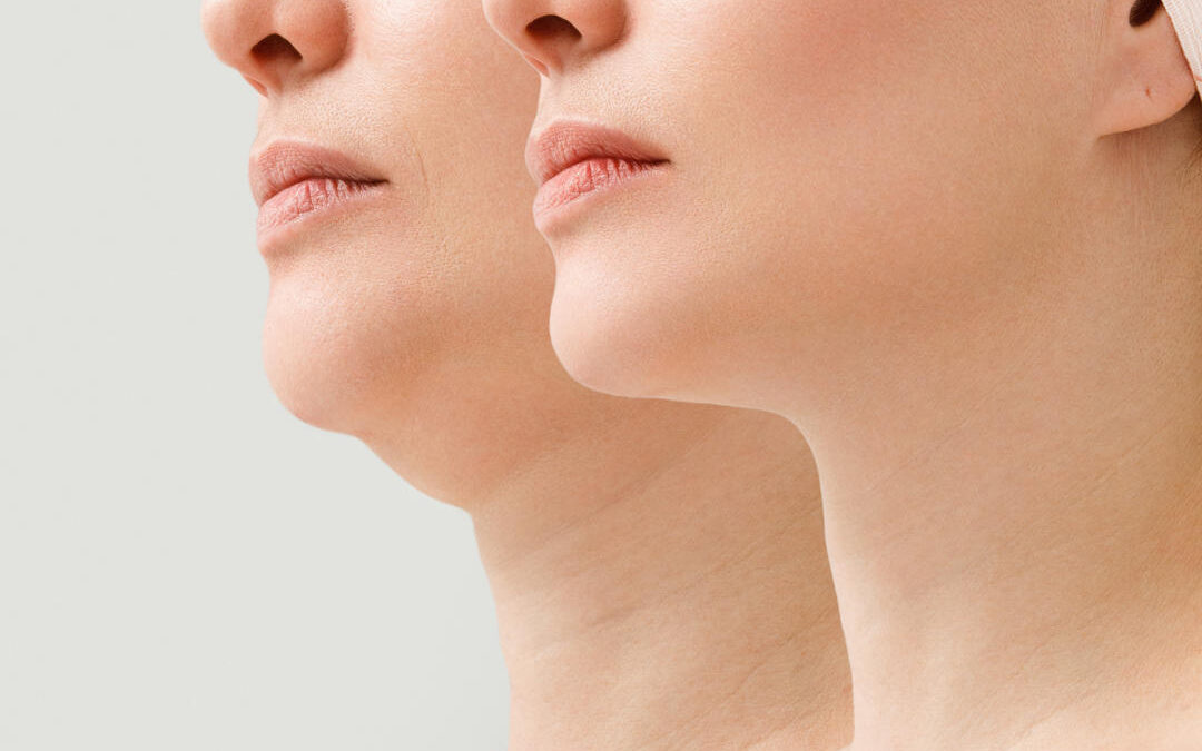 The Executive Facelift: Look Younger Without Taking Time Off